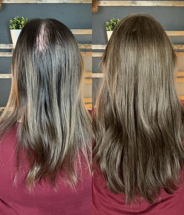 Topo De Cabeça (Cabelo Humano) - Para Alopecia, Falhas, Cabelos Ralos e com Queda