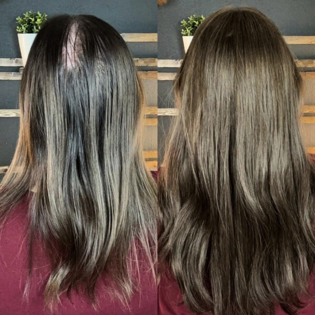 Aplique Topo de Cabeça - Fibra Orgânica (Para Alopecia, Falhas, Cabelos Ralos e com Queda) Resultado Trás