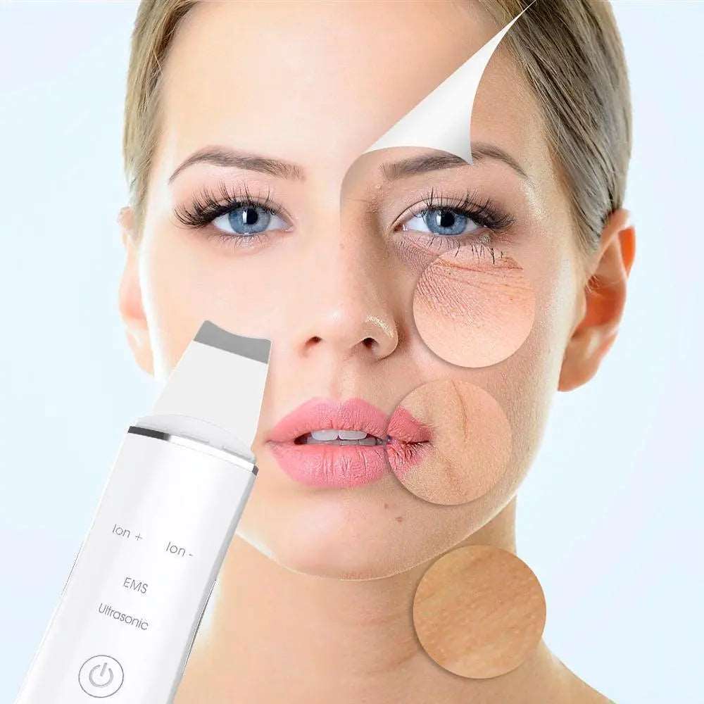 Peeling Eletrônico - Ultrassonic Face™