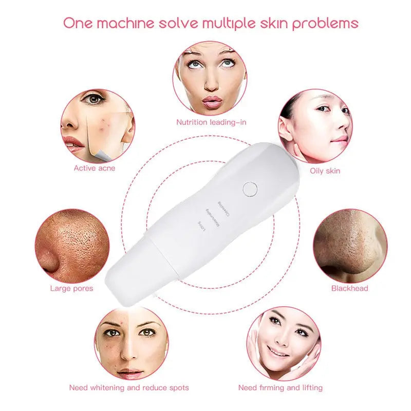Peeling Eletrônico - Ultrassonic Face™