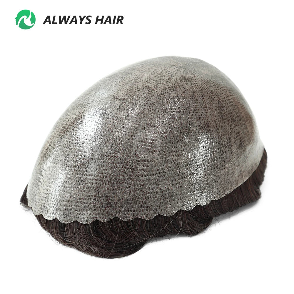 Prótese Capilar Masculina - Para Calvície