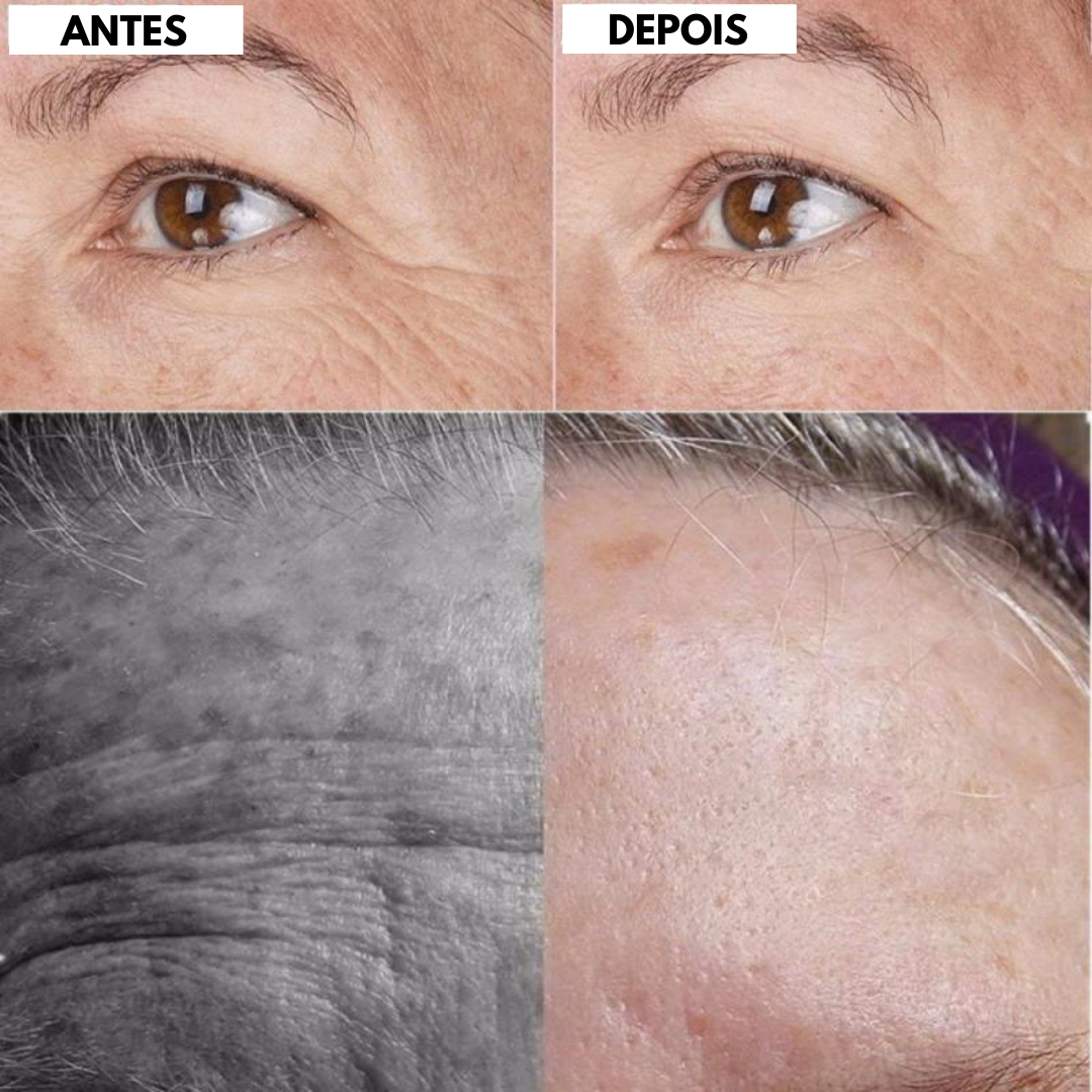 Skin Lifter  - Adesivo Rejuvenescedor (Promoção) - Magazine All In