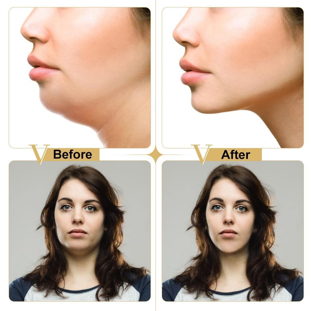 Máscara V-Shape - Magazine All In